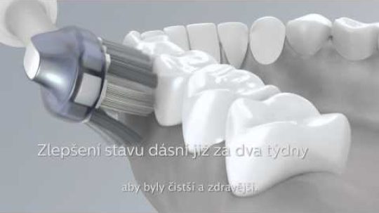 Sonický zubní kartáček Philips Sonicare FlexCare Platinum s režimem DeepClean